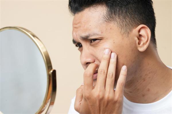 Asian man popping pimple on cheek while standing near mirror