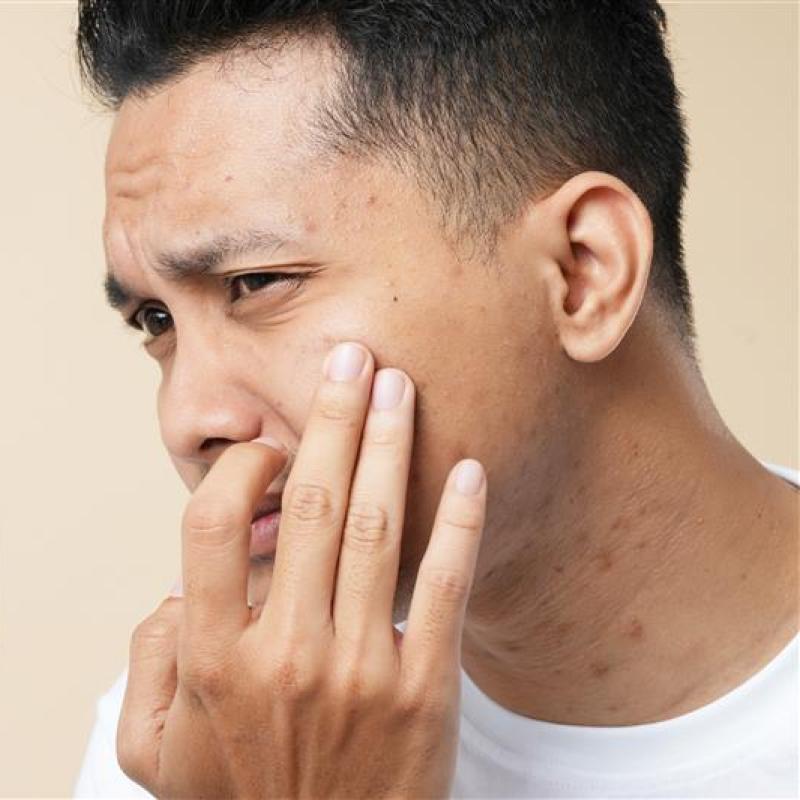 Asian man popping pimple on cheek while standing near mirror