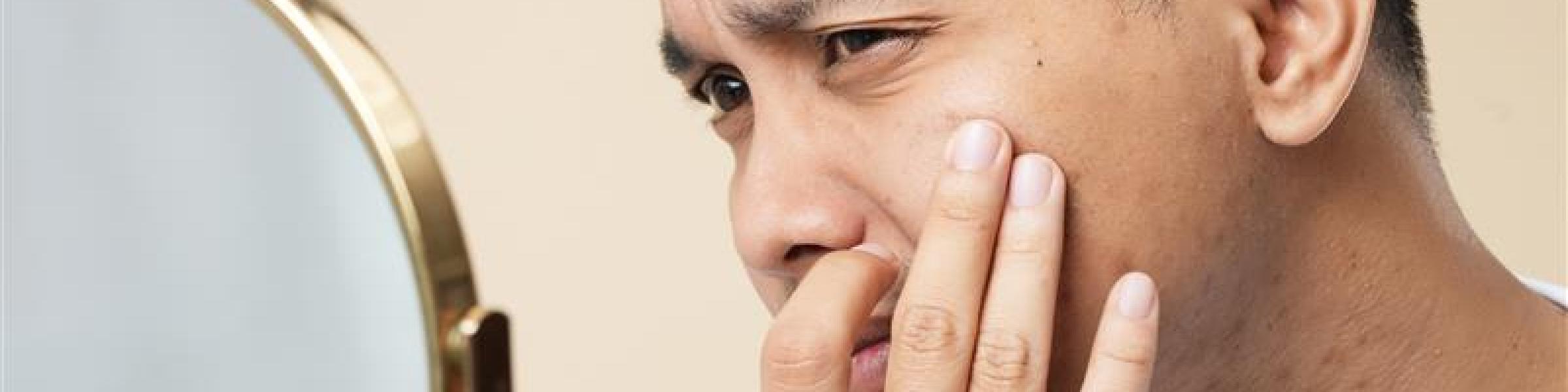 Asian man popping pimple on cheek while standing near mirror